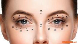 Nốt ruồi ở sống mũi có ý nghĩa như nào? Có nên xoá nốt ruồi không?